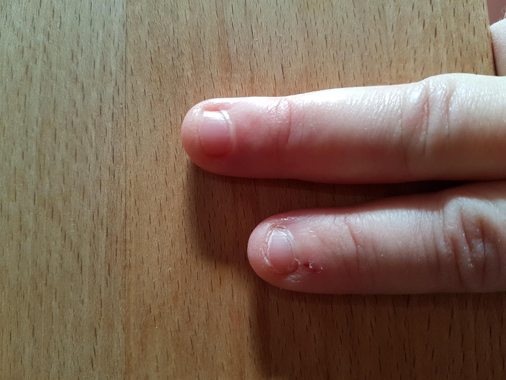 Super für Nagelhaut