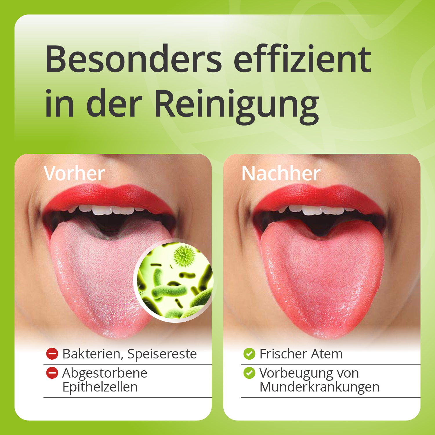 casida-zungenreiniger-edelstahl-zungenschaber-mundhygiene image 3